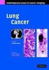 Desai, S: Lung Cancer