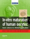 In Vitro Maturation of Human Oocytes