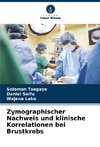 Zymographischer Nachweis und klinische Korrelationen bei Brustkrebs