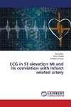 ECG in ST elevation MI and its correlation with infarct related artery
