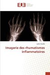 Imagerie des rhumatismes inflammatoires