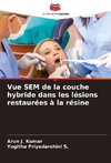 Vue SEM de la couche hybride dans les lésions restaurées à la résine