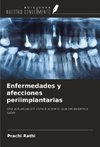 Enfermedades y afecciones periimplantarias