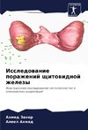 Issledowanie porazhenij schitowidnoj zhelezy