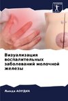 Vizualizaciq wospalitel'nyh zabolewanij molochnoj zhelezy