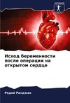 Ishod beremennosti posle operacii na otkrytom serdce