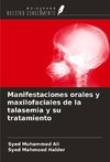 Manifestaciones orales y maxilofaciales de la talasemia y su tratamiento