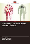 Un aperçu du cancer du col de l'utérus