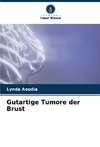 Gutartige Tumore der Brust