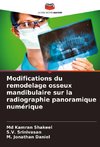 Modifications du remodelage osseux mandibulaire sur la radiographie panoramique numérique