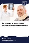 Retenciq w chelüstno-licewom protezirowanii