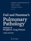 Dail and Hammar's Pulmonary Pathology 2
