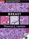 Lawton, T: Breast