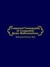 Computed Tomography of Congenital Brain Malformations
