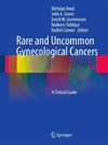 Rare and Uncommon Gynecological Cancers
