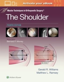 Master Techniques in Orthopaedic Surgery: The Shoulder, 4th Edition