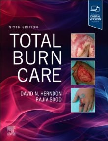 Total Burn Care, 6th Edition