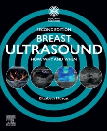 Breast Ultrasound, 2nd Edition