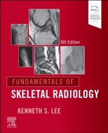  Fundamentals of Skeletal Radiology, 6th Edition