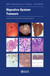 WHO Classification of Tumours. Digestive System Tumours. Fifth Edition