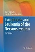 Lymphoma and Leukemia of the Nervous System
