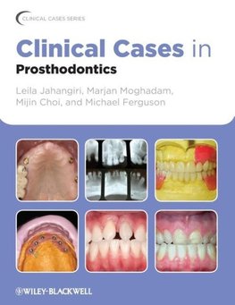 Clinical Cases in Prosthodonti