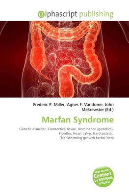 Marfan Syndrome