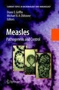 Measles