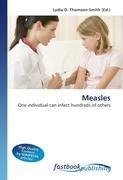 Measles