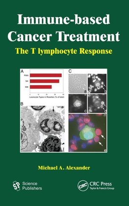 Immune-based Cancer Treatment
