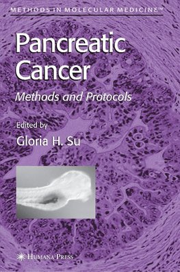 Pancreatic Cancer