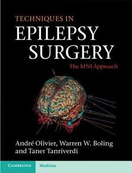 Techniques in Epilepsy Surgery