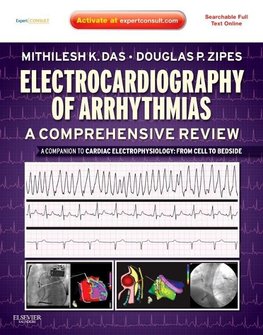 Electrocardiography of Arrhythmias: A Comprehensive Review