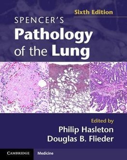 Spencer's Pathology of the Lung 2 Part Set