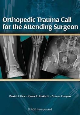 Orthopedic Trauma Call for the Attending Surgeon
