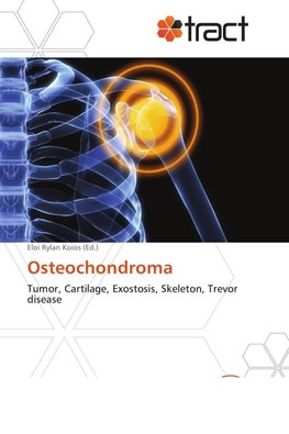 Osteochondroma