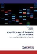 Amplification of Bacterial 16S rRNA Gene