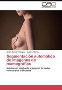 Segmentación automática de imágenes de mamografías