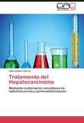 Tratamiento del Hepatocarcinoma