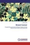 Breast Cancer