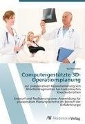 Computergestützte 3D-Operationsplanung