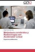 Metástasis cerebrales y Radiocirugía con Acelerador Lineal