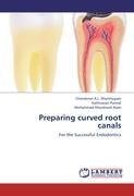 Preparing curved root canals