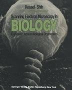 Scanning Electron Microscopy in BIOLOGY