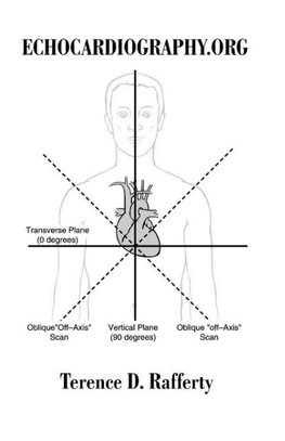 Echocardiography.Org