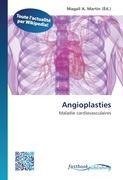 Angioplasties