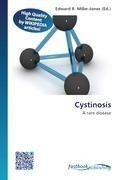 Cystinosis