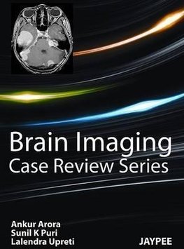 Brain Imaging