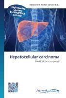 Hepatocellular carcinoma