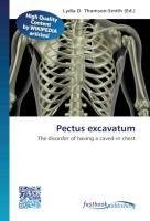 Pectus excavatum